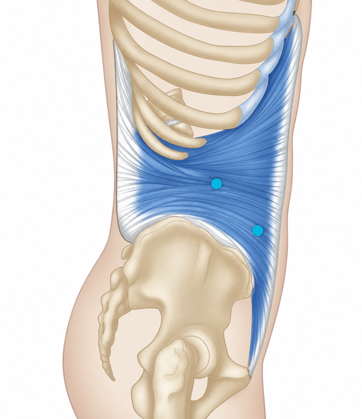 Transversus Abdominis · Common trigger-point sites. Common trigger-point site examples in the illustrated region.
