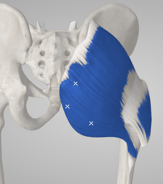 Figure 02 · Trigger regions. Gluteus maximus. Representative source regions; not numbered point assignments.