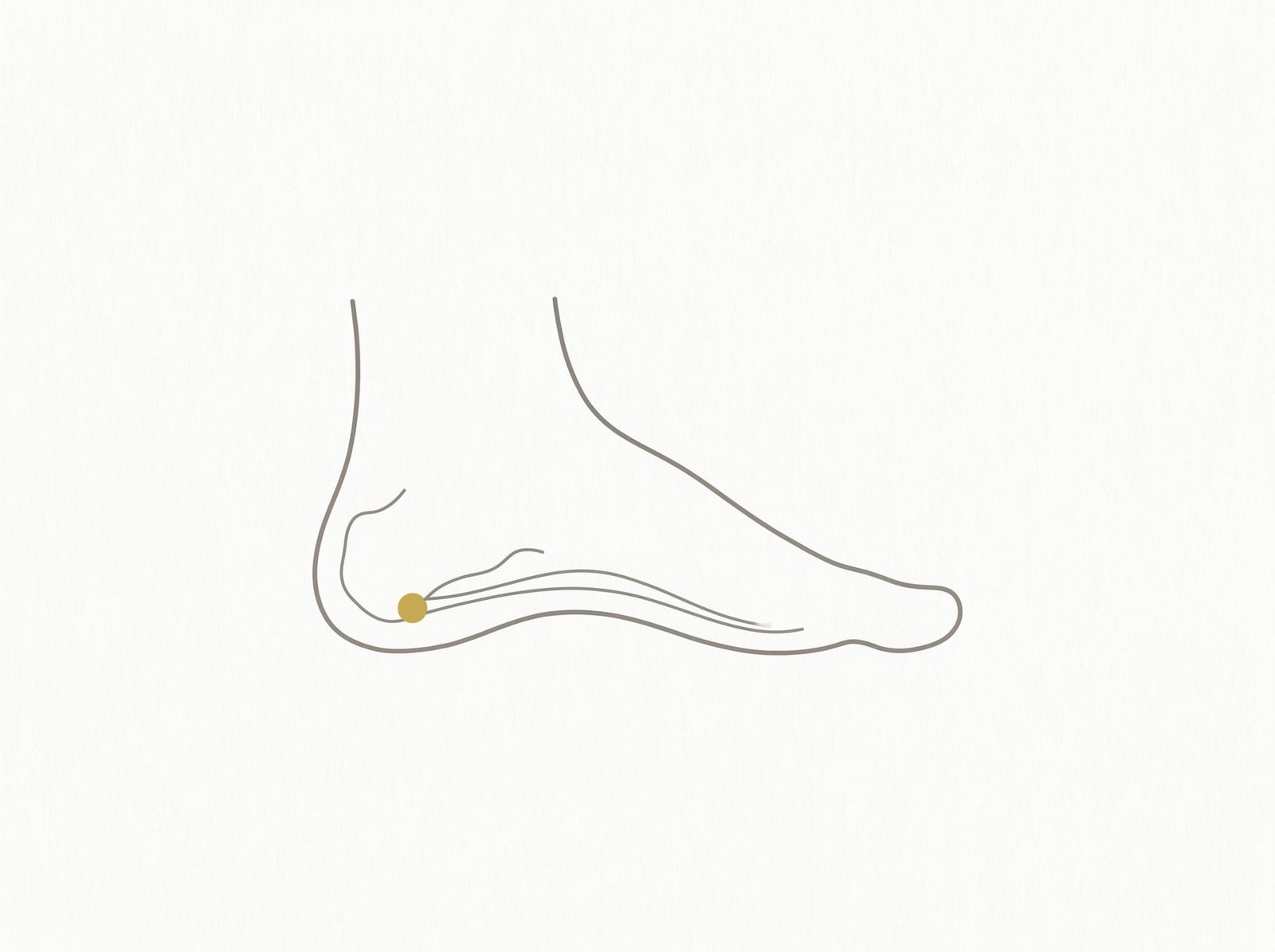 Fersenschmerz und Plantarfasziitis-Imitatoren