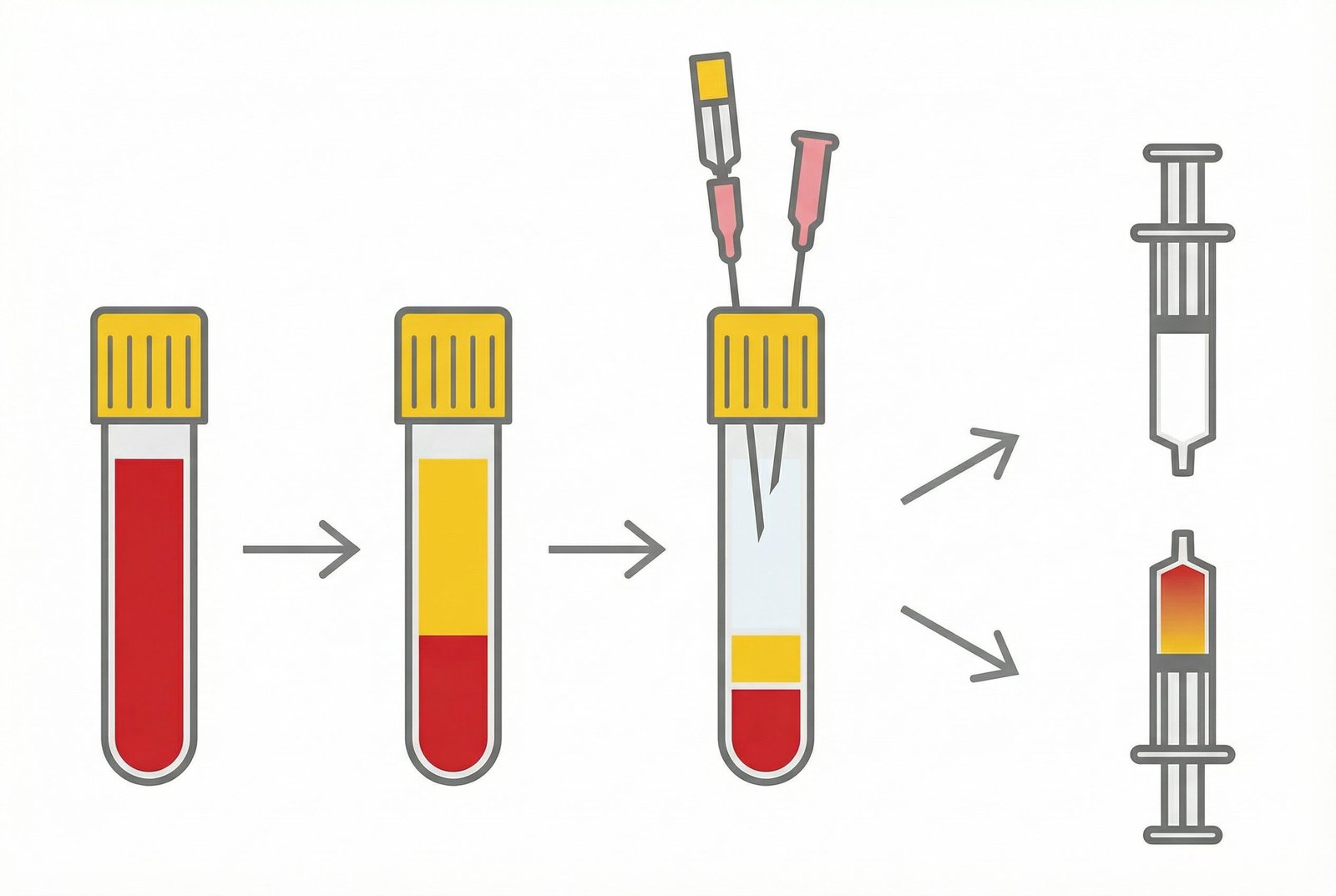 PRP-Aufbereitungsprotokoll