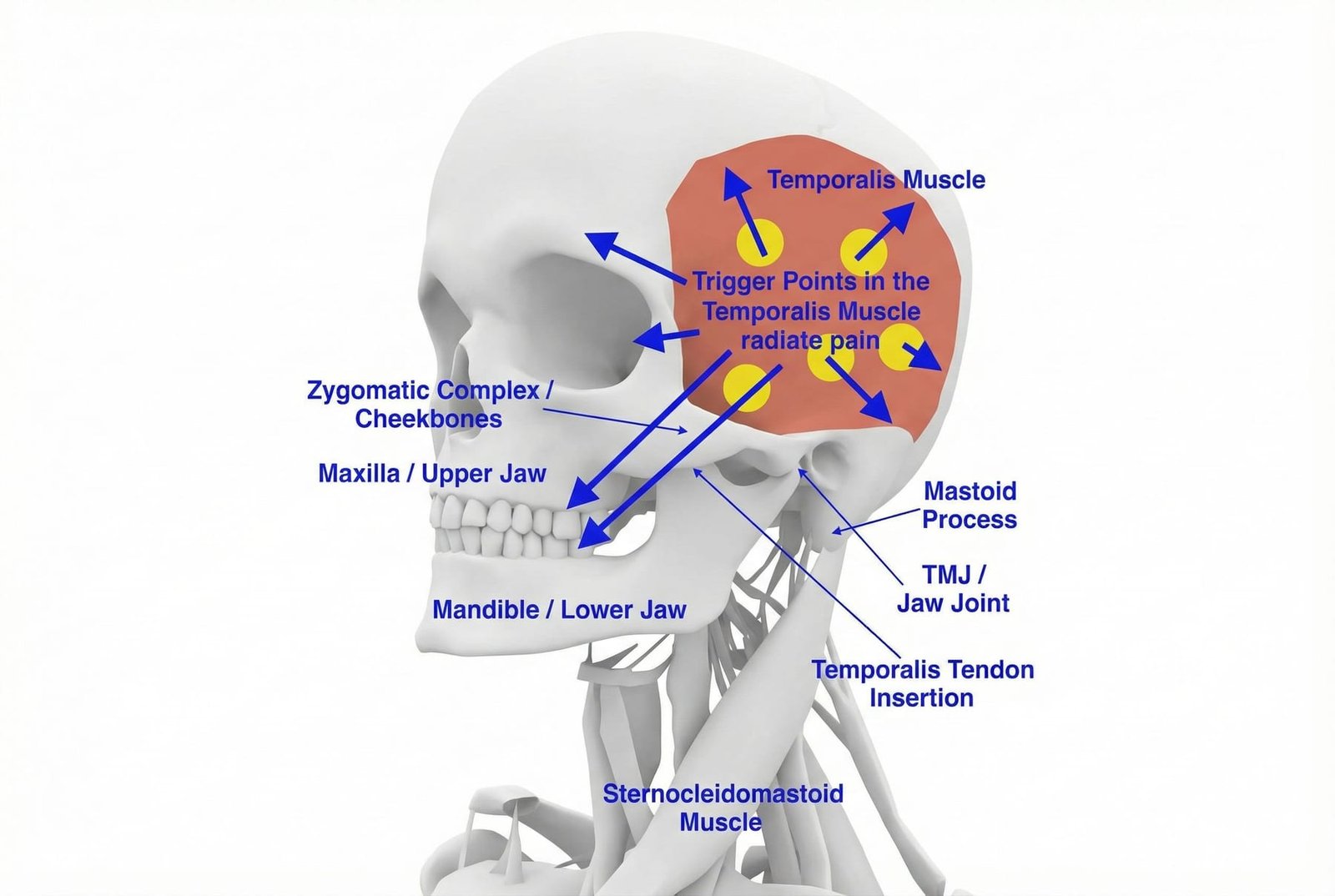 Temporalis Self-Massage Technique and Jaw Stretching Exercises